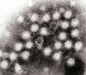 Norovirus.  Photo by GrahamColm at en.wikipedia [GFDL (http://www.gnu.org/copyleft/fdl.html) or CC-BY-3.0 (http://creativecommons.org/licenses/by/3.0)], from Wikimedia Commons