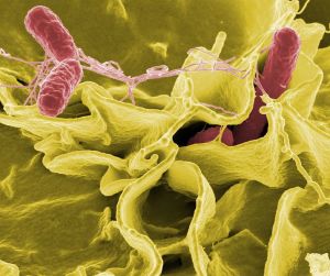 Salmonella invading an immune cell. Photo By National Institutes of Health (NIH) (National Institutes of Health (NIH)) [Public domain], via Wikimedia Commons